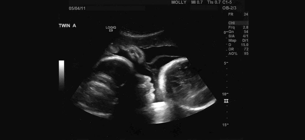 УЗИ на 36 неделе беременности - фото