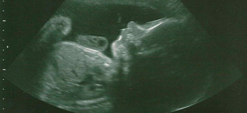 УЗИ на 28 неделе беременности - фото