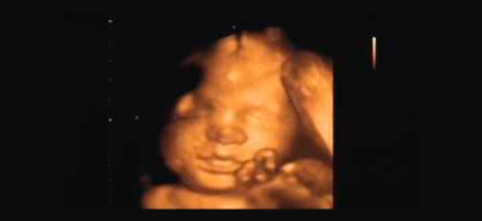 УЗИ на 31 неделе беременности - фото