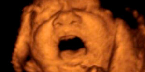 при беременности болит низ живота 38 неделя беременности thumbnail