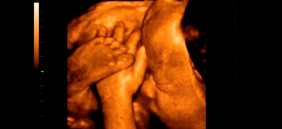 УЗИ на 41 неделе беременности - фото