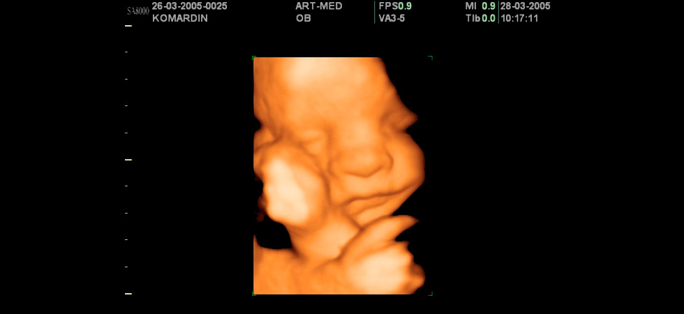 32 недели беременности фото плода на узи
