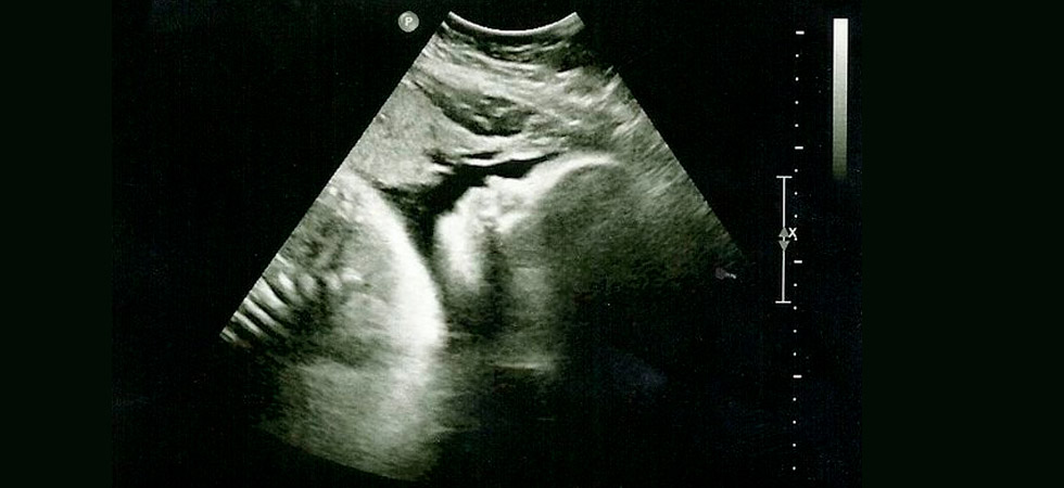 УЗИ на 32 неделе беременности - фото
