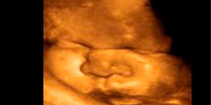 38 недель беременности болит живот поясница и ноги
