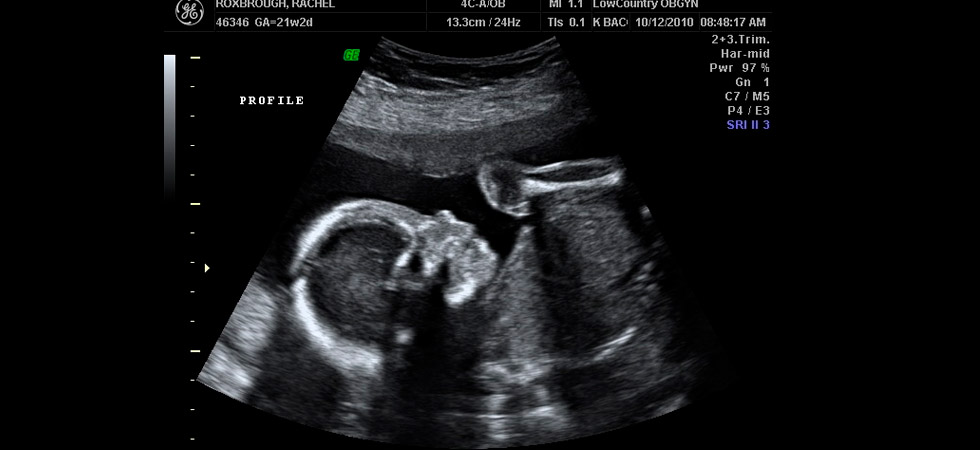 УЗИ на 27 неделе беременности - фото