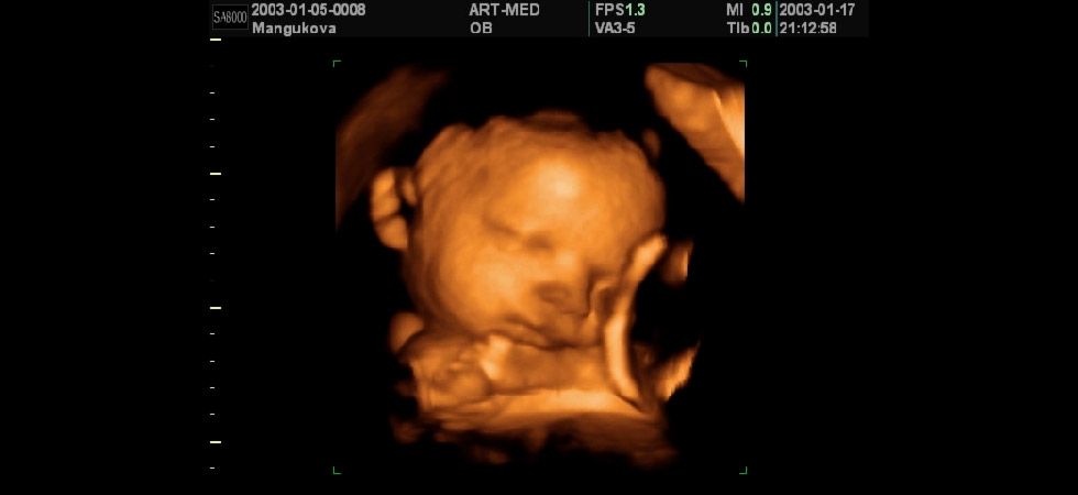 УЗИ на 33 неделе беременности - фото
