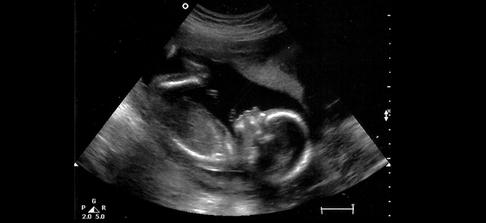 УЗИ на 19 неделе беременности - фото