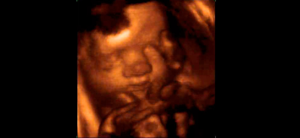 УЗИ на 42 неделе беременности - фото