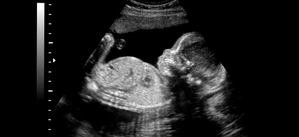 22 неделя беременности фото ребенка